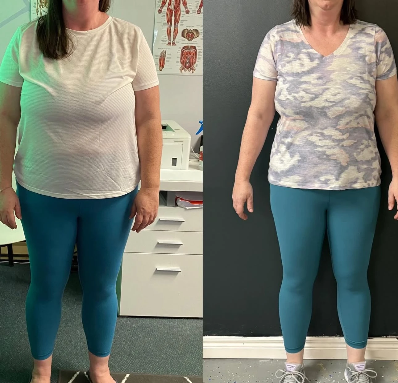 Enhanced member progress comparison 5